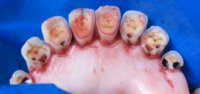 Détermination de l'âge des ovins en utilisant la dentition - Exemple 3: dentition des ovins âgés de 12 mois et plus