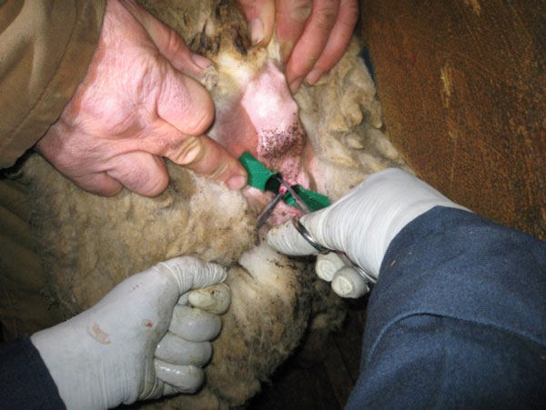 Figure 26 Photo of taking rectal mucosa biopsies