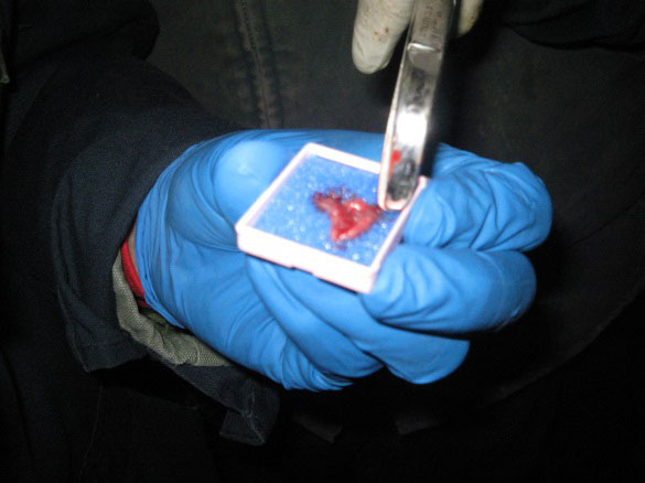 Figure 28 – Photo du placement l'échantillon de muqueuse rectale prélevé par biopsie dans une cassette