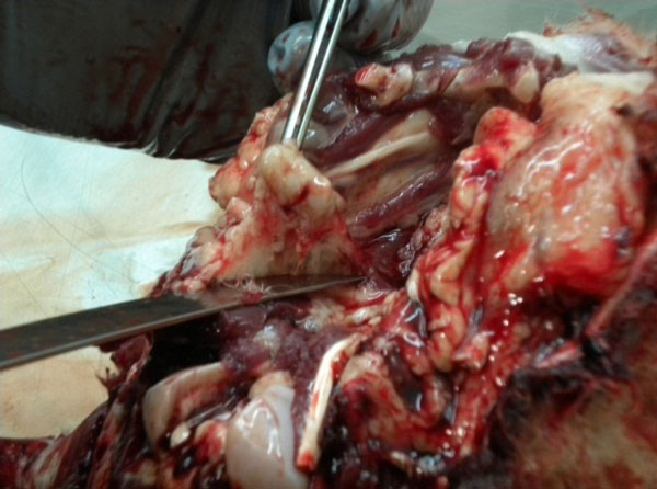 Figure 22 - Photo of  RPLNs after dissection from connective tissue