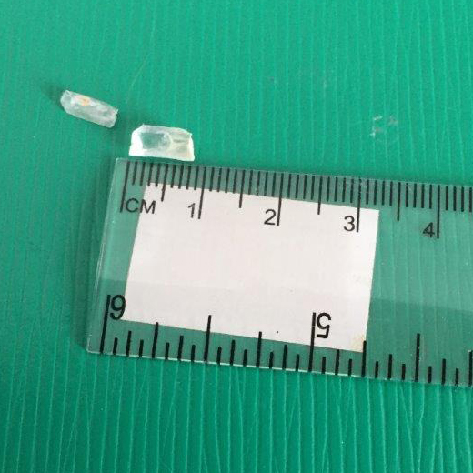 struvite next to a ruler measuring less than 1 centimetre
