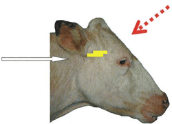 Perpendicular to the Front of the Head Approach - Side View
