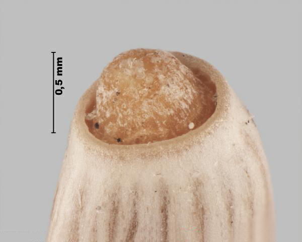 Figure 4 - Chardon épineux (Carduus acanthoides) sommet de l'akène