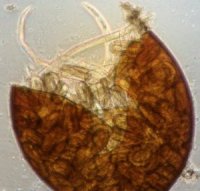 Le nématode doré (Globodera rostochiensis) est un ver rond microscopique invertébré qui ne présente aucun risque pour la santé humaine.