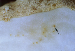 Brown egg sacs (brown spots) in the cortex of a cut tuber.