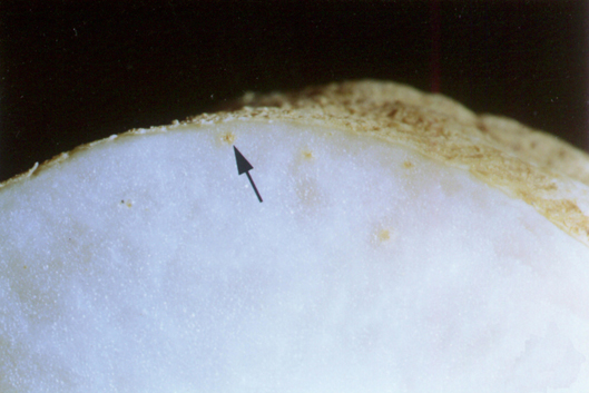Embedded female below a gall.