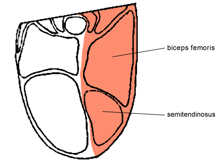 Fesse extérieur