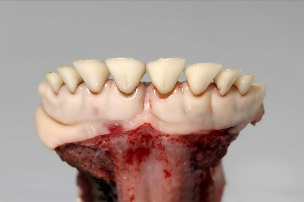 < 24 mois Dentition de lait complète