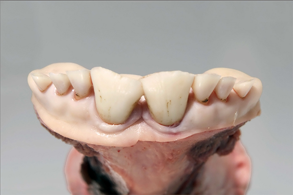 >24 months <30 months Pair of primary permanent incisors fully erupted
