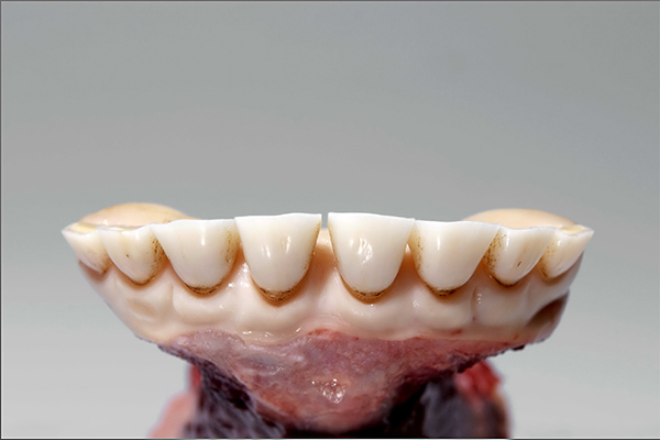 >30 months Complete permanent dentition