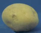 Tubercule