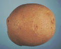 Tubercule