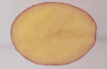 tubercule tranché