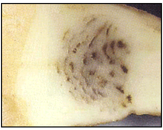 Photo 64 - Virus du sommet touffu de la pomme de terre – nécrose interne. Description ci-dessous.