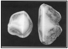 Picture 74 | Chilling injury of the vascular tissue. Description follows.