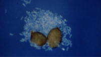 Example of Potato cyst nematode